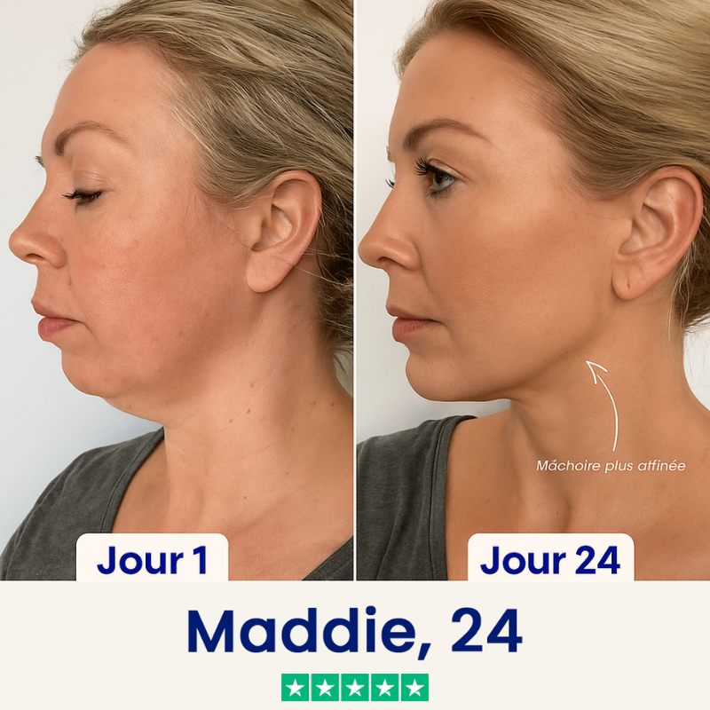 Liftée – Goodbye Double Chin