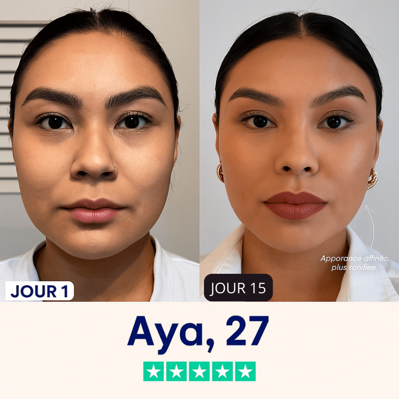 Liftée – Goodbye Double Chin