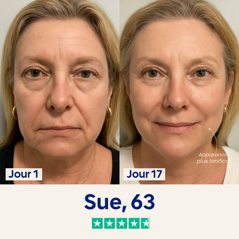 Liftée – Goodbye Double Chin