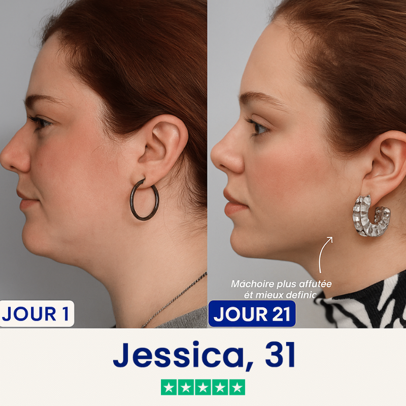 Liftée – Goodbye Double Chin